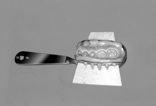 Ложка прикусная типа K, для боковых зубов от магазина Stom-Prof