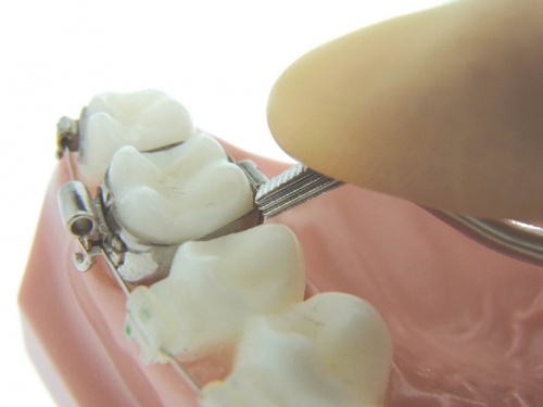 Инструмент для установки ортодонтических колец YDM от магазина Stom-Prof