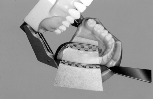 Ложка прикусная типа K, для боковых зубов от магазина Stom-Prof