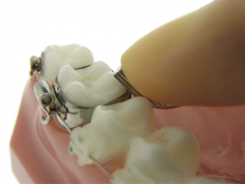 Инструмент для установки ортодонтических колец YDM от магазина Stom-Prof